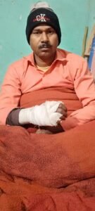 नहर किनारे जन अधिकार पार्टी के जिलाध्यक्ष विकास मौर्य पर हुआ जानलेवा हमला, हमले में हाथ के पंजा हुआ फैक्चर